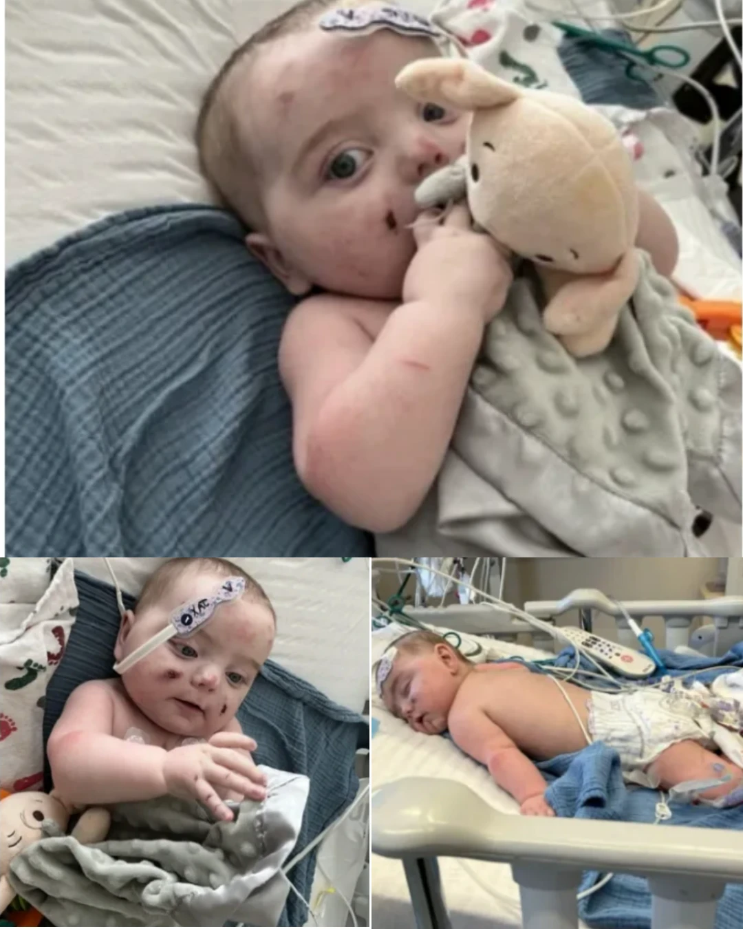 Against All Odds: Jax's Incredible Fight for Life in the Cardiac ICU 317