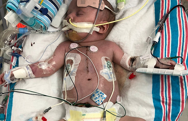 Breaking: How Baby Griffin Johnson Overcame Life-Threatening Congenital Heart Defects Through Expert Pediatric Cardiac Care at Holtz Children’s Hospital 5889