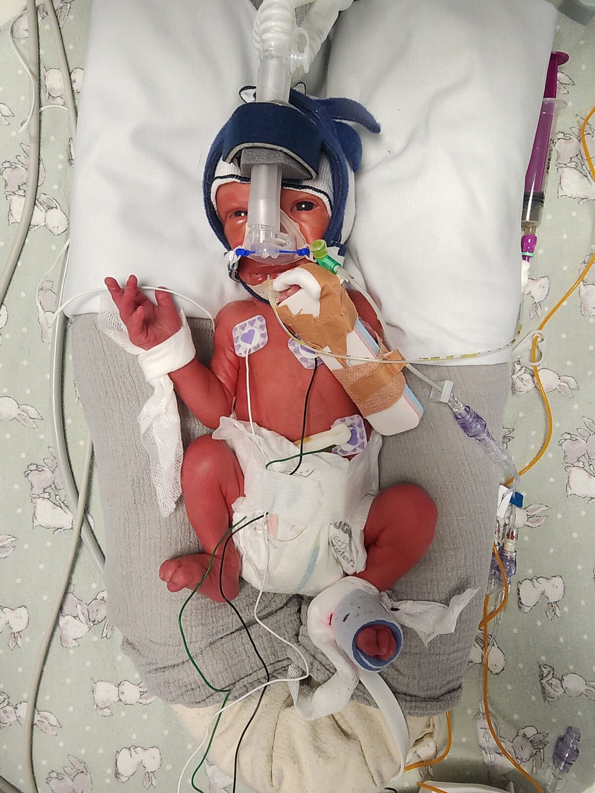 Becoming a Mumma – William’s 33-Week Journey 5925
