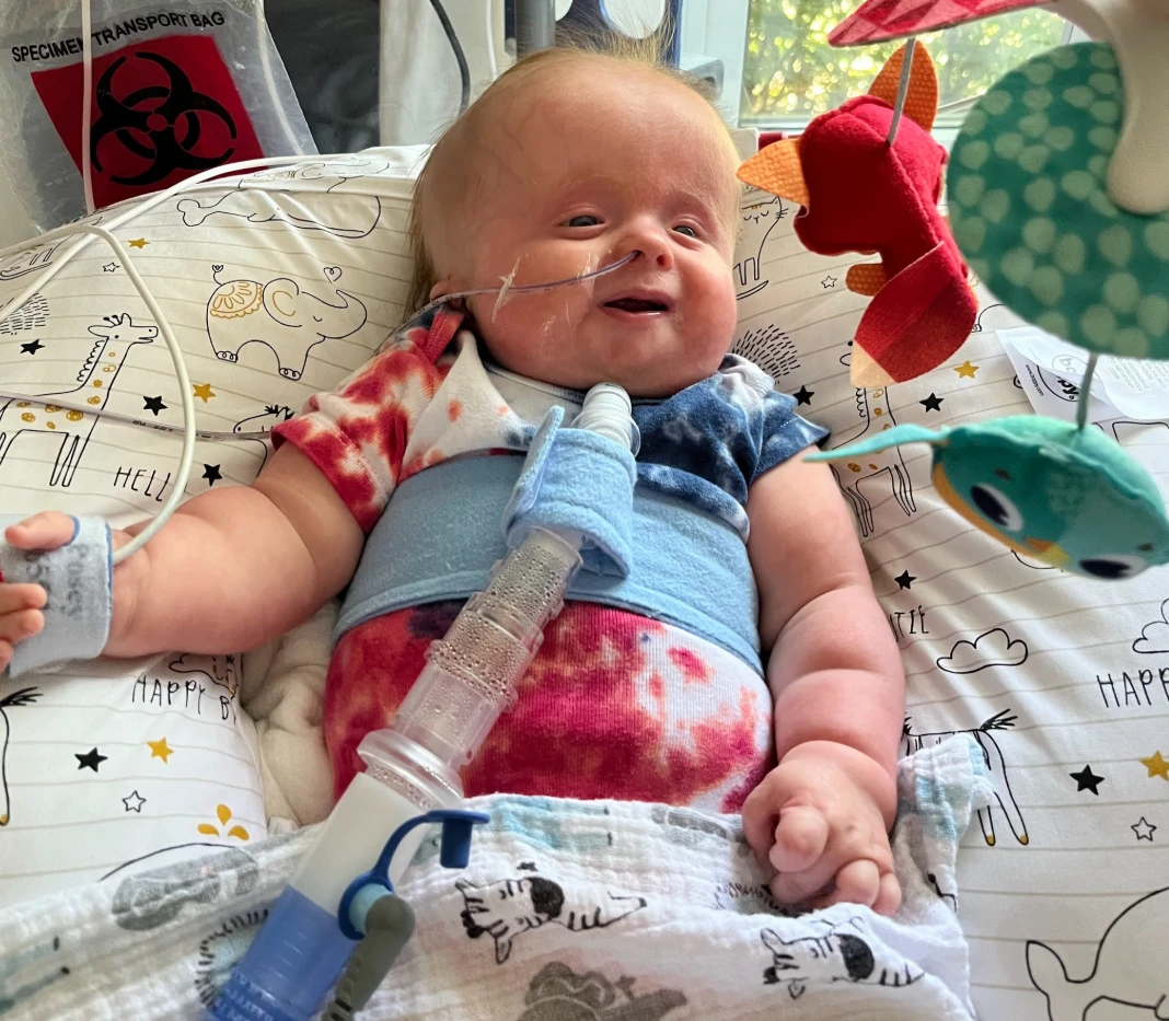 A Life Defined by Love: Luke's Courageous Fight Against Trisomy 18 4080