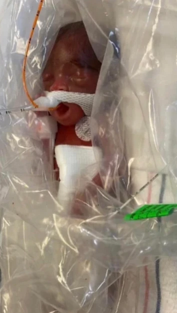 Breeze’s Journey: From a 22-Week Preemie to Strength, Growth, and Inspiration Offers Hope for Families Everywhere 5773