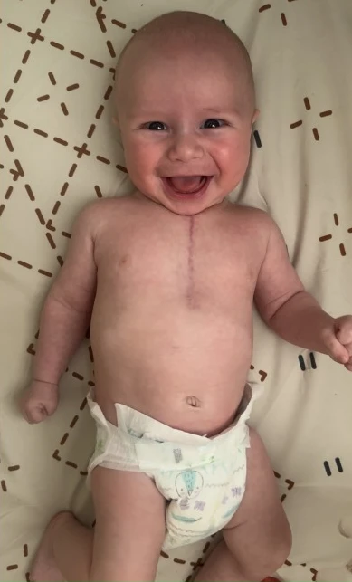 Liam's Journey: From a Heart Diagnosis to a Thriving First Year 5943