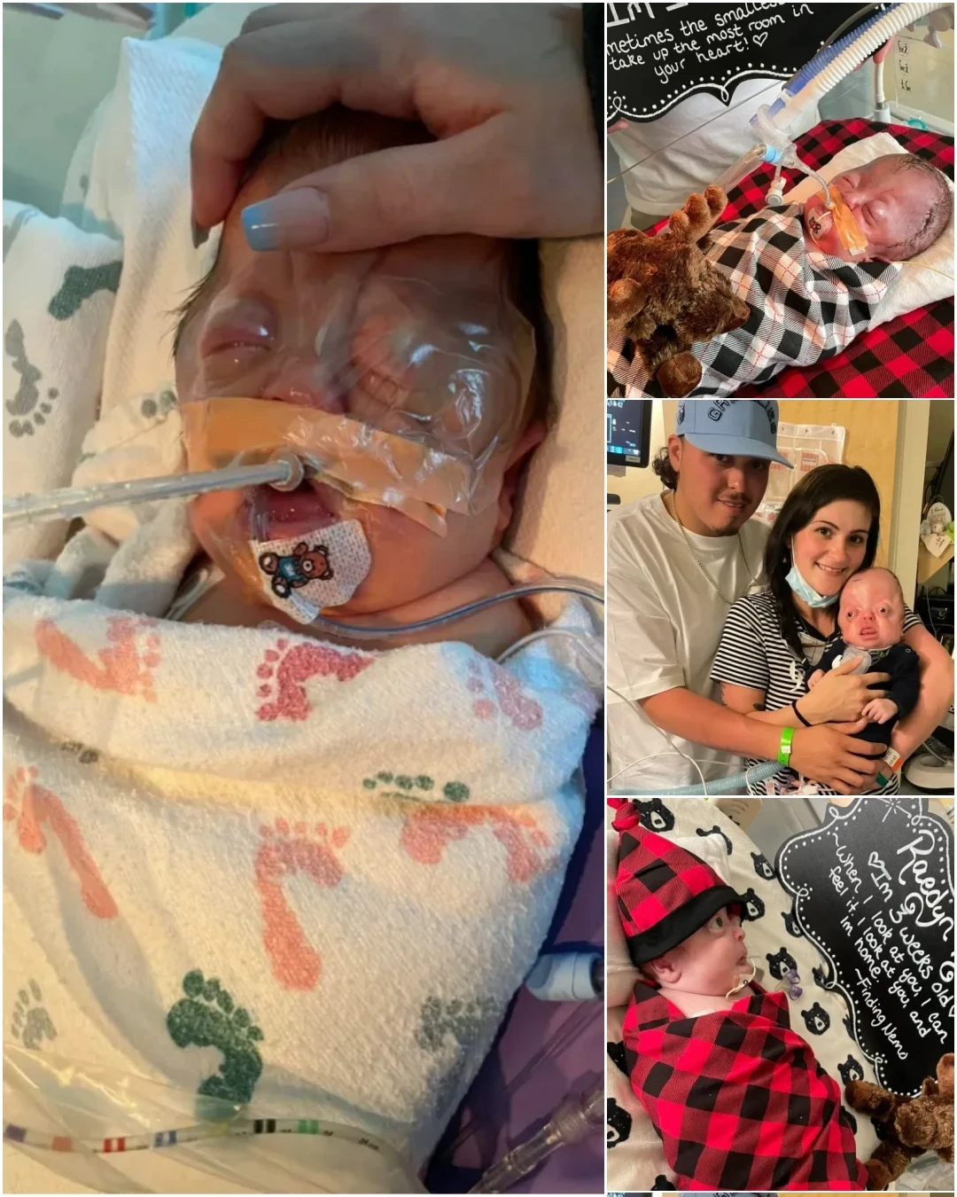 A Journey of Resilience: Julian and Raedyn’s Fight for Life in the NICU 307