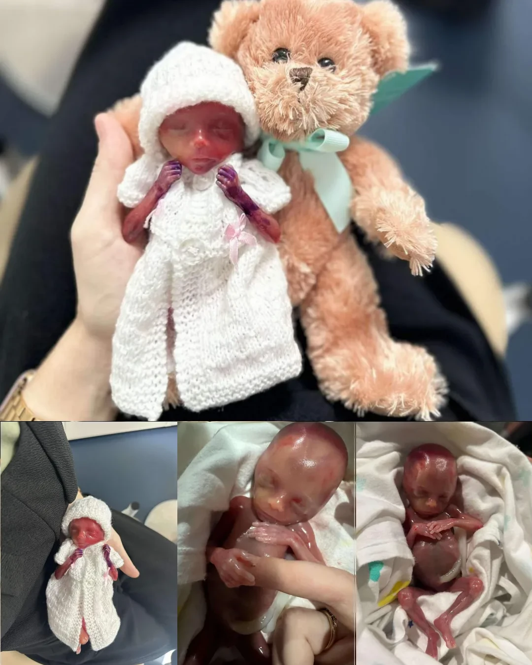 A Life Defined by Love: Quinley’s Journey of Hope, Loss, and Enduring Connection 316