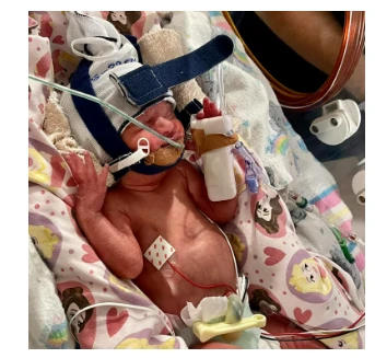 Georgia’s Fight for Life: A Journey from NICU to Strength 289