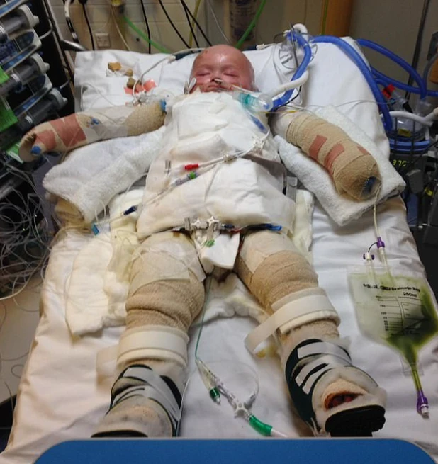A Fight for Life: Jenson Smith’s Journey Through Pain, Recovery, and Resilience 4164