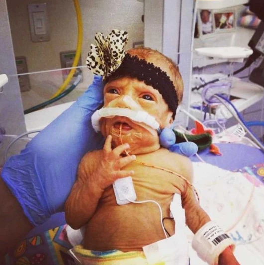 Miracles in the NICU: How Nurses Transformed Grief into Hope for Our Family 300