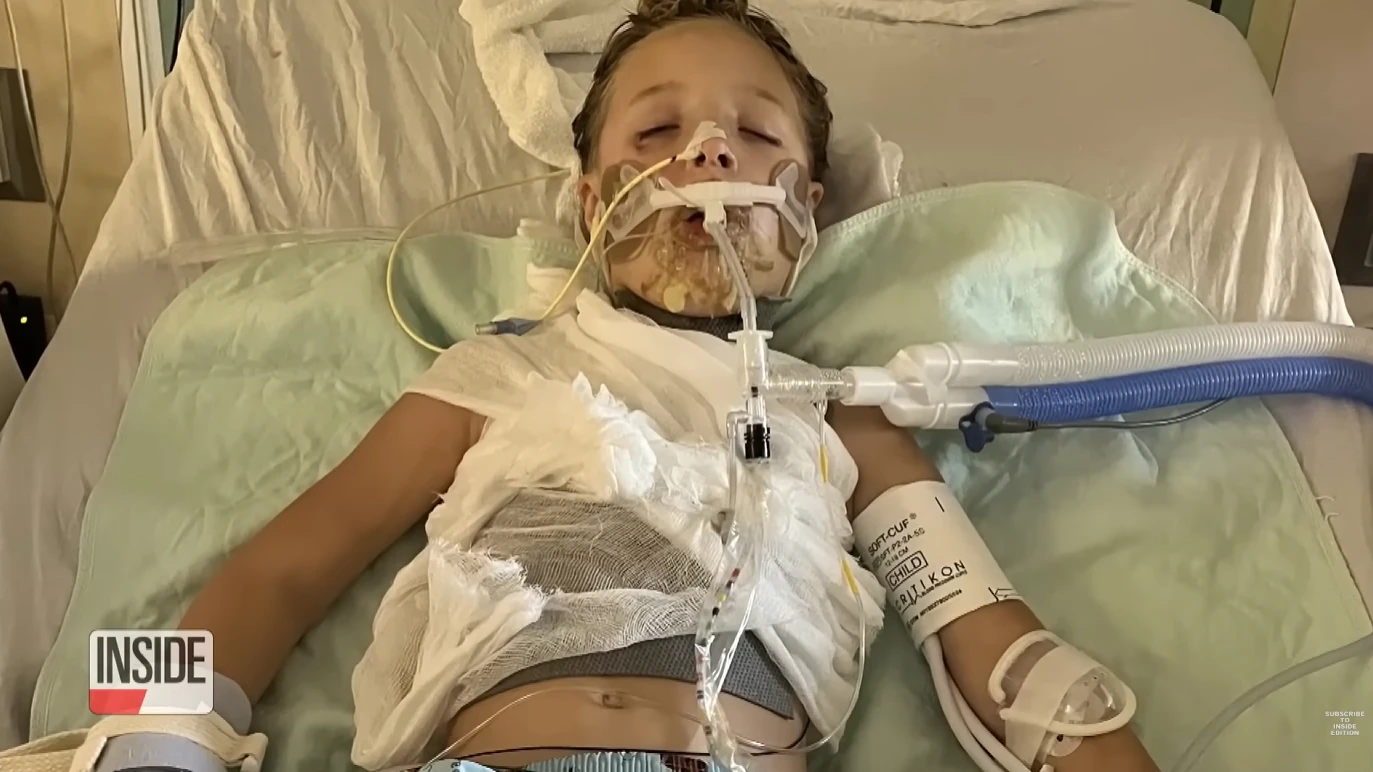 A Toy Gone Wrong: Scarlett’s Journey Through Pain and Recovery After a Dangerous Viral Trend 4122