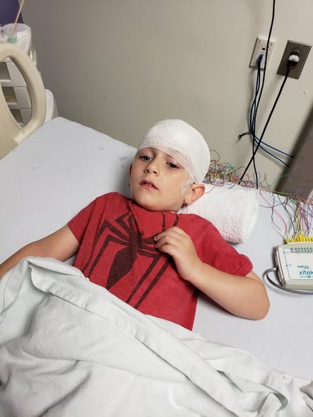 Eli’s Journey: Overcoming Focal Cortical Dysplasia and Seizures with Strength and Resilience 6006