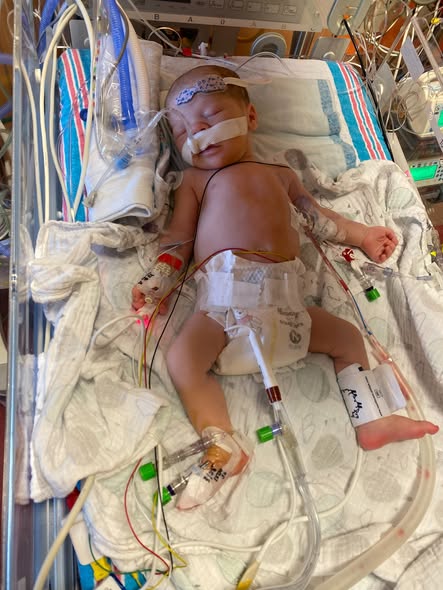 Andrew’s Journey: A Heart Warrior’s Triumph Over Congenital Heart Defects 5993