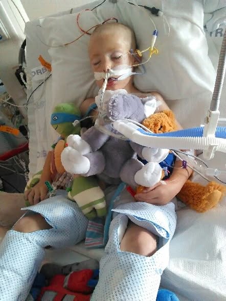 Zane's Journey: From Life-Threatening Illness to Triumph Over Arteriovenous Malformation 5992