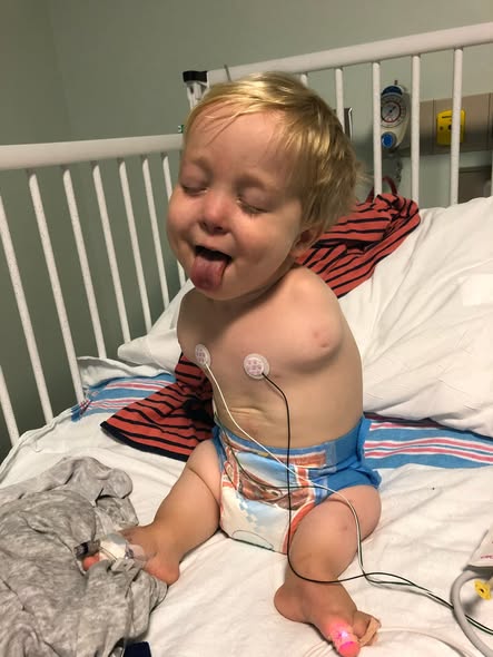 Harrison’s Journey: Overcoming Challenges with Scoliosis and Phocomelia, and the Innovation that Transformed His Care 5991