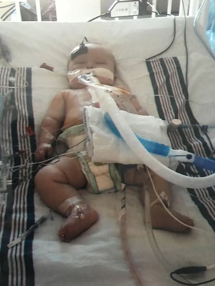 Anderson’s Brave Heart: A Journey of Strength, Survival, and Unwavering Support 5957