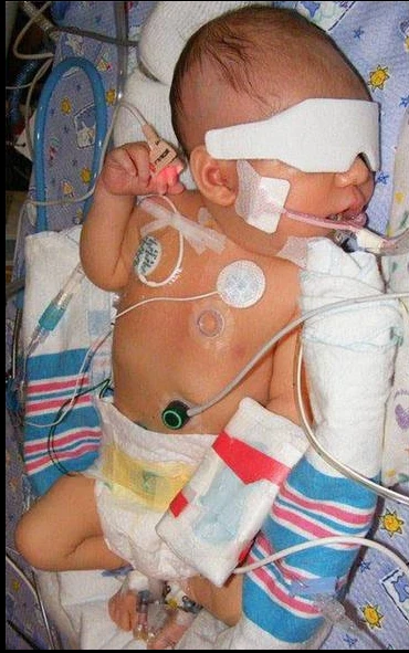 "Brody’s Miracle Journey: From Congenital Diaphragmatic Hernia to a Healthy and Happy 5-Year-Old" 6036