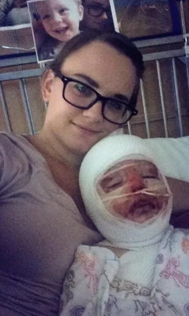 A Warrior's Journey: Jax’s Battle with Burns and His Unbreakable Resilience 4119