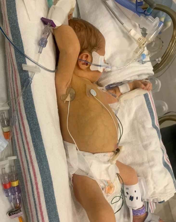 Henry’s Fight for Life: A Miracle Baby Defying the Odds 4072