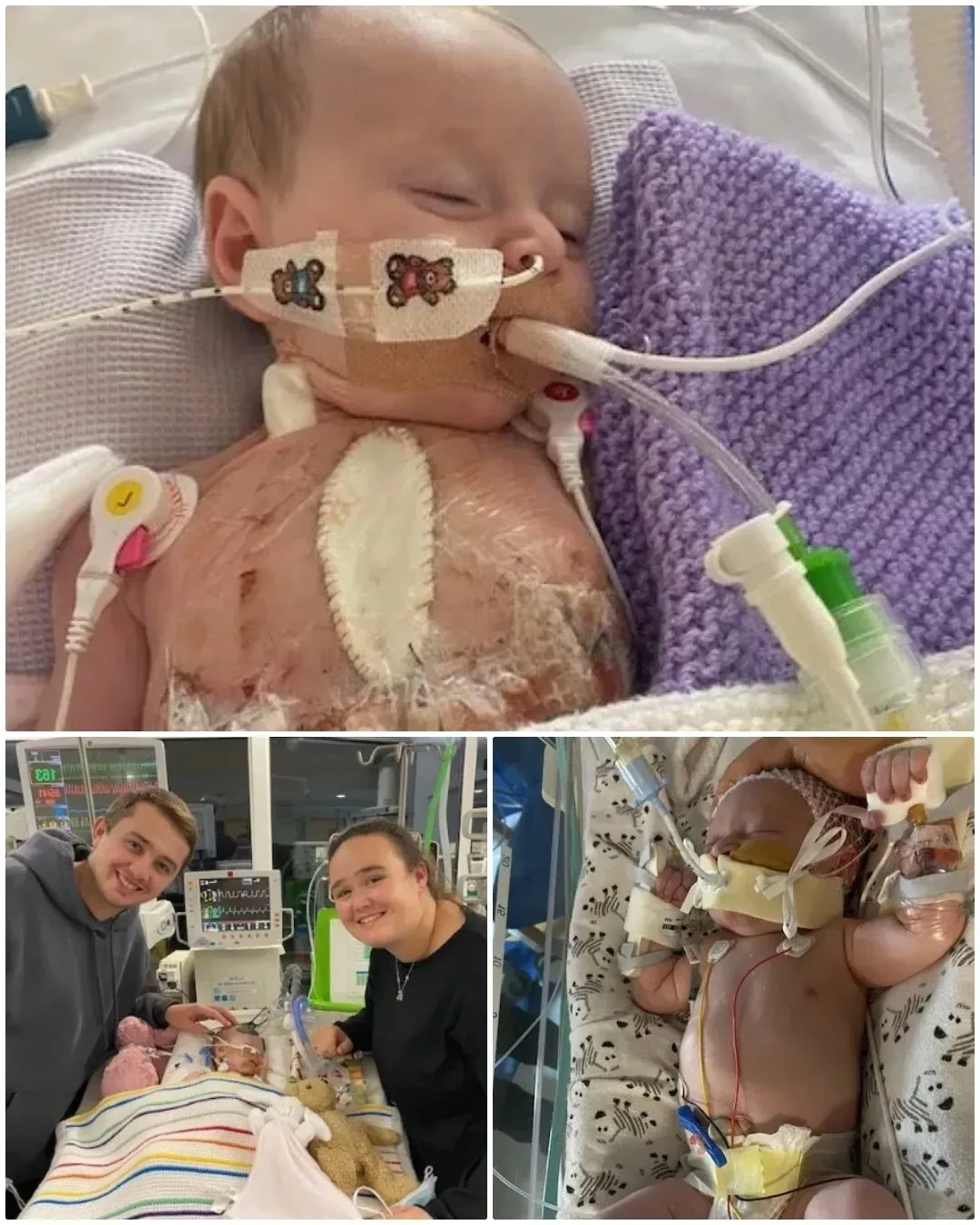 Amelie’s Struggle for Life: A Heartbreaking Journey of Courage and Survival 286
