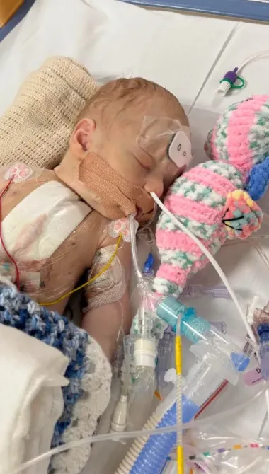A Heart of Courage: Archie’s Battle with Transposition of the Great Arteries and His Journey to Survival 310