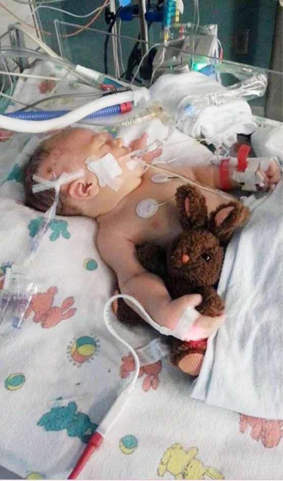 "Levi’s Miracle: From a 50% Survival Chance to Celebrating His First Birthday" 6043