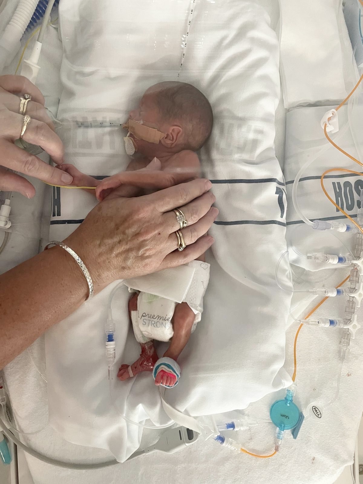 Kiwa Louise Jane: A Tiny Warrior's Journey Through NICU and the Love That Will Last Forever 5921