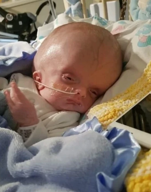 A Miracle Against All Odds: Lorenzo’s Fight for Life with Hydrocephalus 341