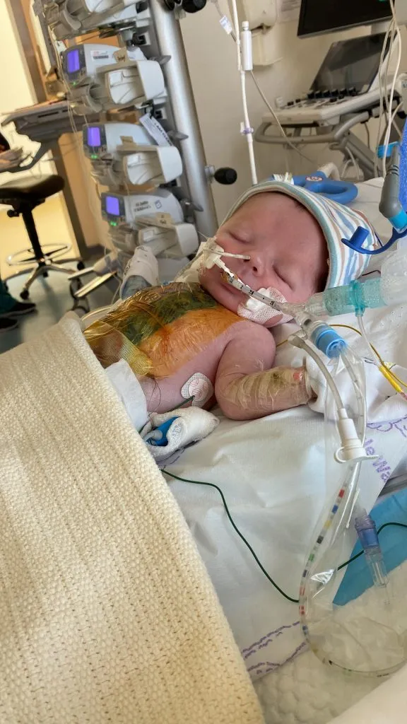 A Tiny Warrior: Alfie’s Incredible Battle for Life Against the Odds 4087
