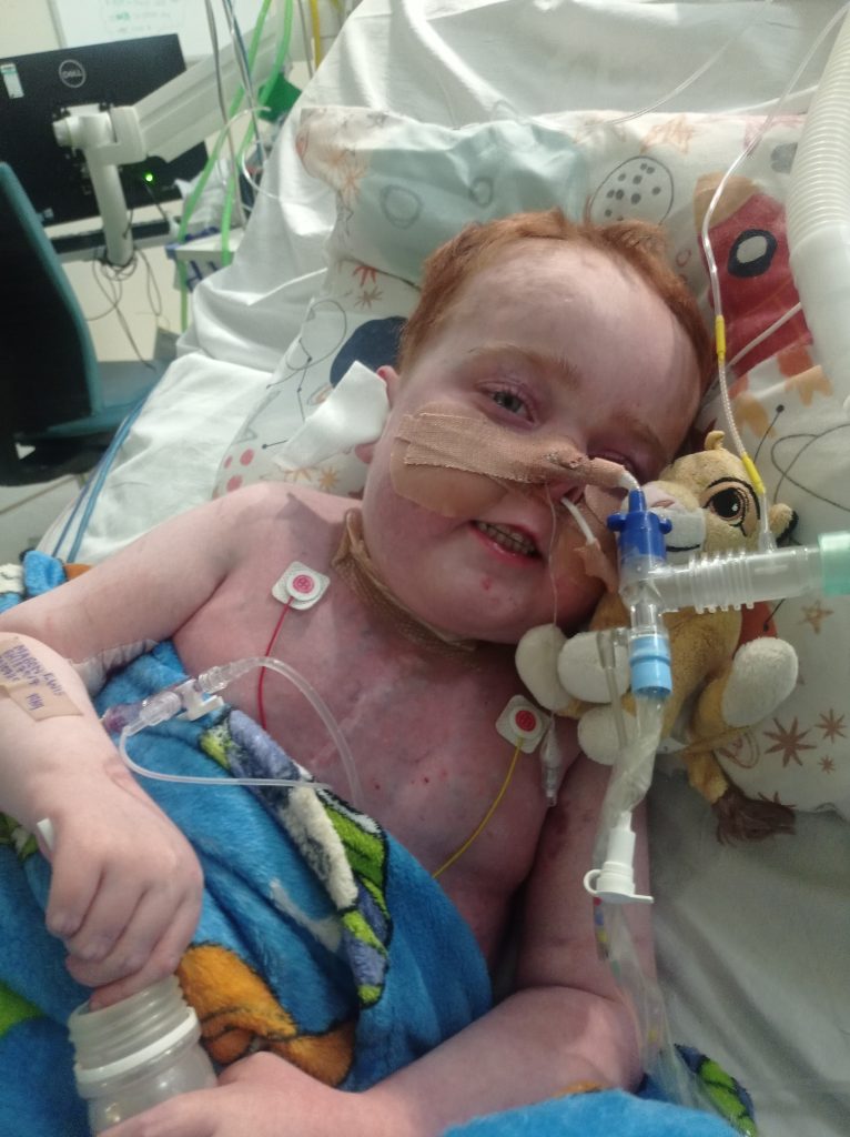 Mabon Gwyn’s Extraordinary Journey How a Family Navigated Life-Threatening Heart Defects, Multiple Surgeries, and Unimaginable Loss While Keeping His Spirit Alive 5877