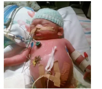A Miracle on Mother’s Day: Dimitra's Journey Through Prematurity and Survival 301