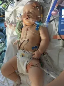 Tetralogy of Fallot: Edie’s Story 5845