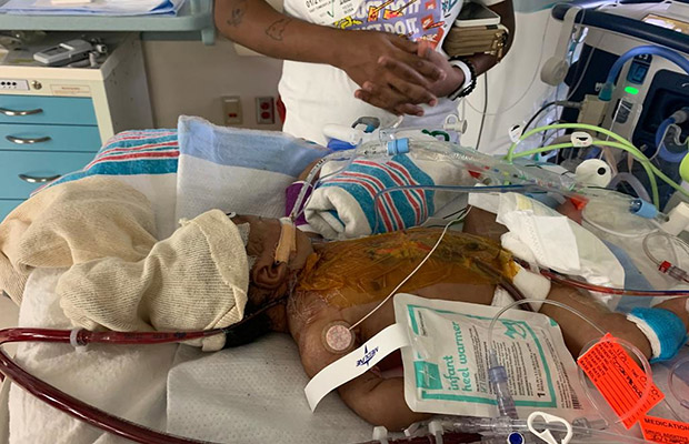 Breaking: How Baby David Survived Severe Congenital Heart Disease Through Lifesaving Interventions at Holtz Children’s Hospital 5895