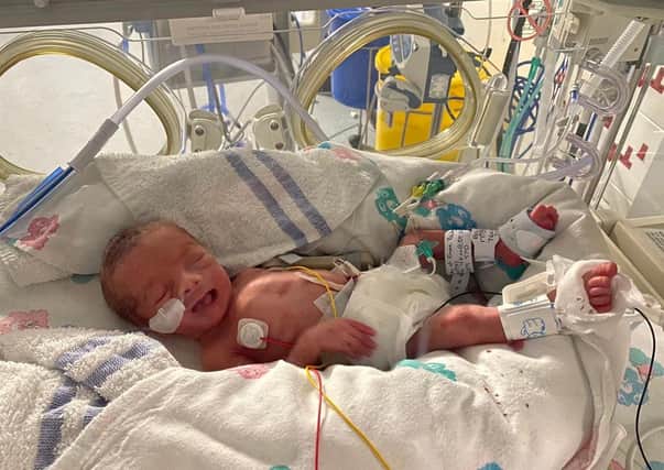 "Archie's Miracle: How a Life-Saving Incubator Helped This Tiny Warrior Survive Against All Odds" 5917