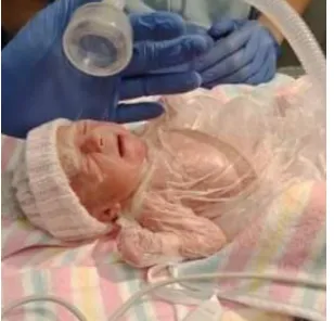 A Miracle in the NICU: Kaylee’s Journey of Strength, Survival, and Hope 312