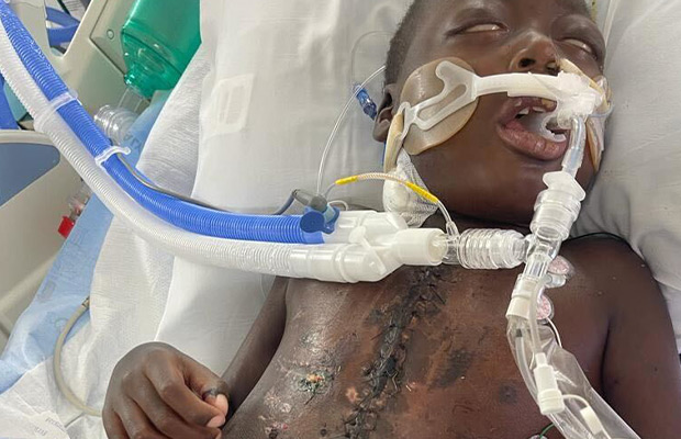 Breaking: How 9-Year-Old Chrisner Claccemus Survived Hypoplastic Left Heart Syndrome Through World-First Pediatric VAD Placement and Heart Transplant at Holtz Children’s Hospital 5891
