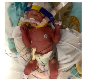 Colby’s Story: A Tiny Fighter’s Journey to Health 5756
