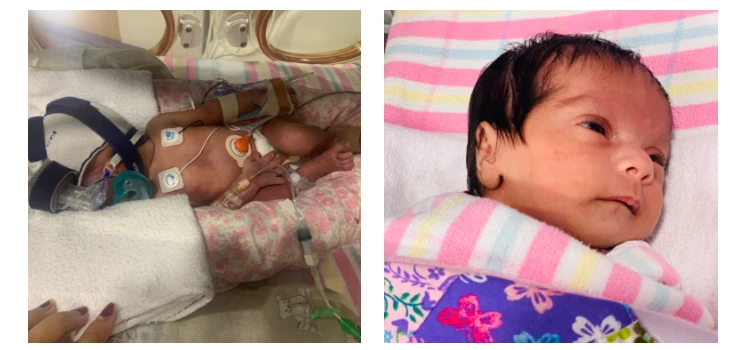 A Miracle of Strength: Pavit’s Journey Through Prematurity, Surgery, and Survival 299