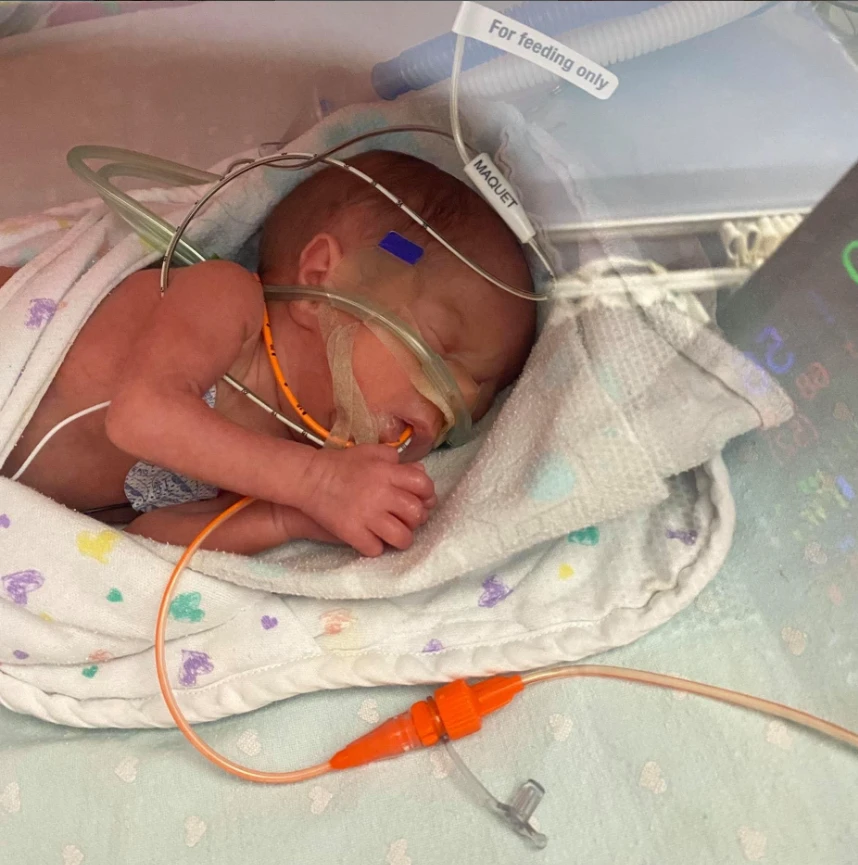 Eliana’s Miracle: From One Pound to a Heart Warrior 5907