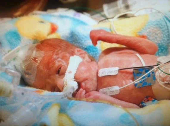 Against All Odds: Loyal’s Fight for Life and Her Family’s Unwavering Love 4135