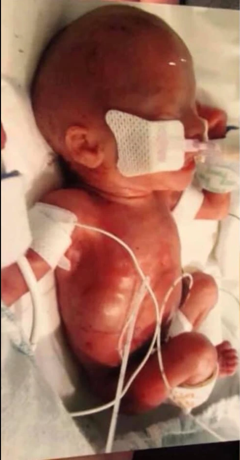 Willow's 5th Birthday: Celebrating the Miracle of Life and the Amazing Care at Nationwide Children's Hospital 5966