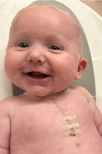 VSD: Ivy’s Heart Journey 5842