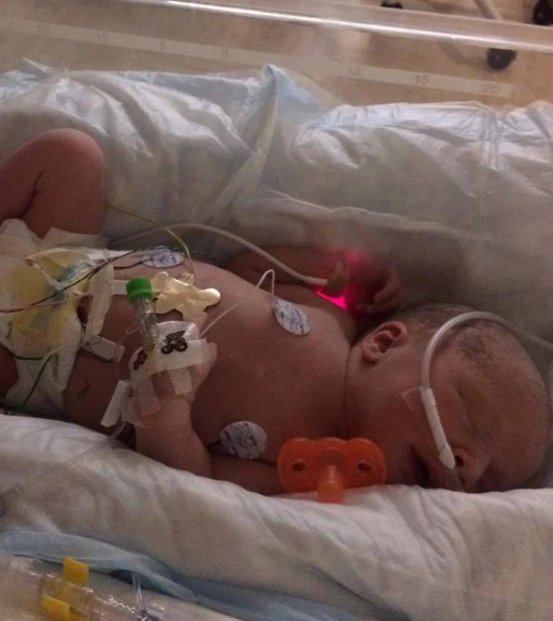 "Charlie Jane's Journey: From Life-Saving Surgeries to a Happy First Birthday at Home" 6041