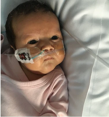 Milly’s Miracle: Overcoming the Odds of Right-Sided CDH and Defying Expectations 5912