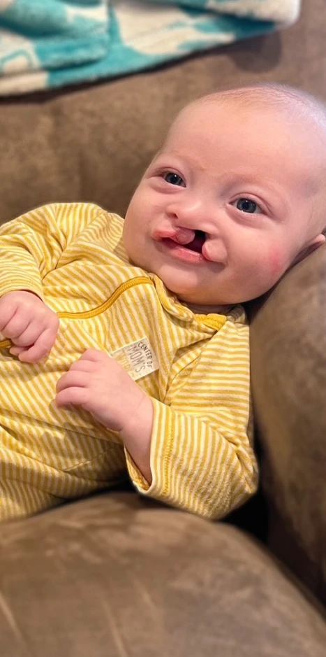 "Henry's Journey: From Cleft Lip and Palate to a Forever Smile, A Story of Love and Resilience" 6021
