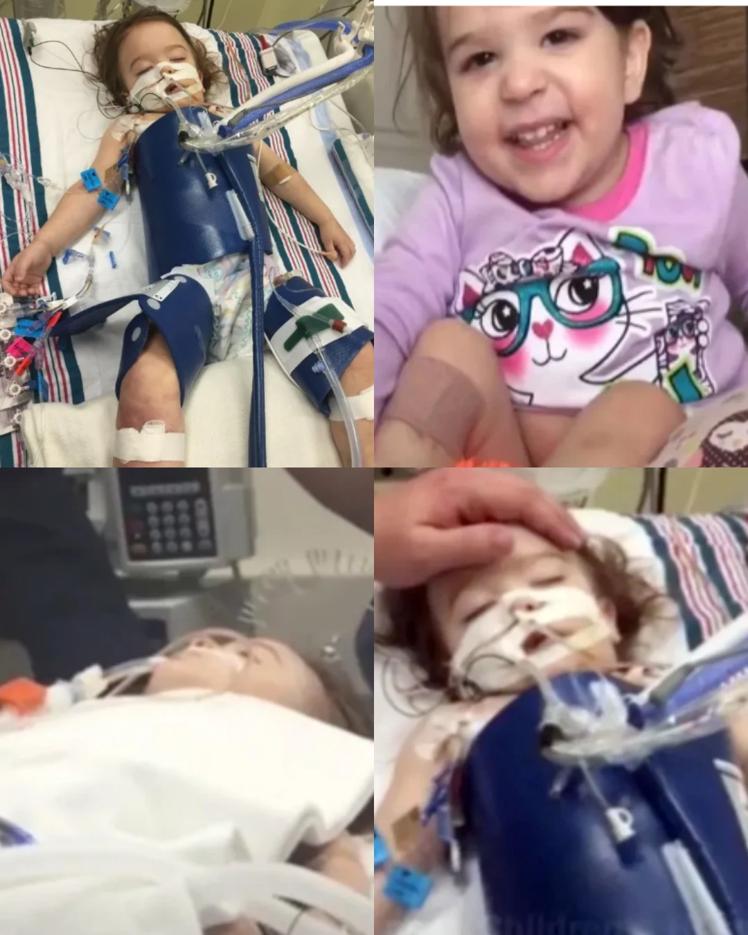 From Brain Dead to Alive: Eden’s Miraculous Recovery Against All Odds 293