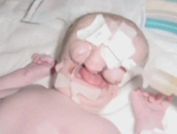 A Life Without a Face: Juliana Wetmore's Journey Through Pain, Surgery, and Hope 4173