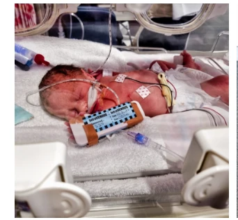 A Miracle in the Making: Rafferty’s Journey from Preemie to Toddler 298