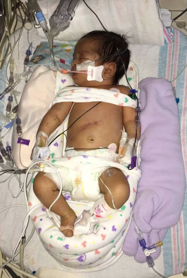 "Liya’s Journey: From NICU to Christmas Joy with Her Nurses" 6040