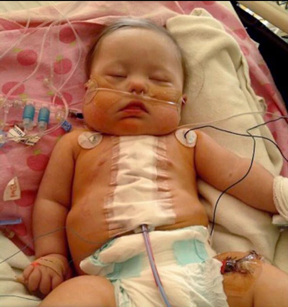 "Kate’s Transformation: From CHD Warrior to a Healthy, Happy First Grader" 6032