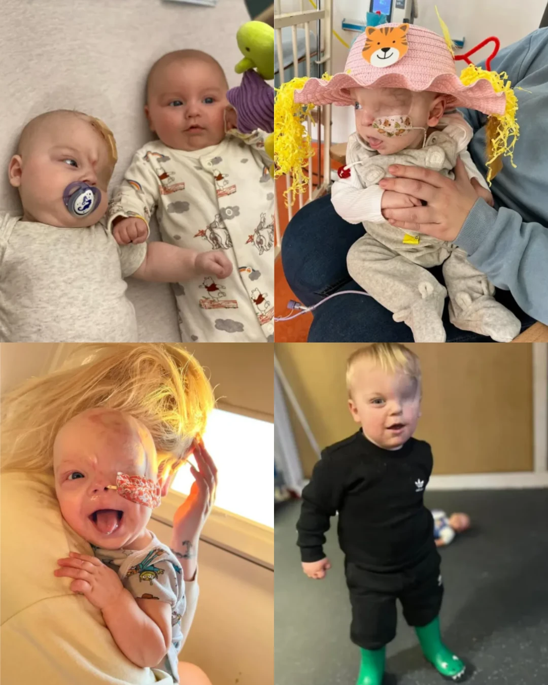 A Small Hero: Caleb’s Journey Through Cancer and the Power of Compassionate Care 304