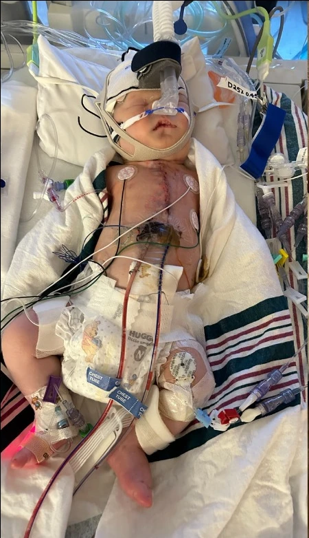 Nolan’s Journey: From Heart Surgery to Thriving Fighter 5945