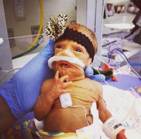 A Journey of Love and Loss: The Miller Family's Fight for Their Babies and the Miracle of Nursing Care 4100